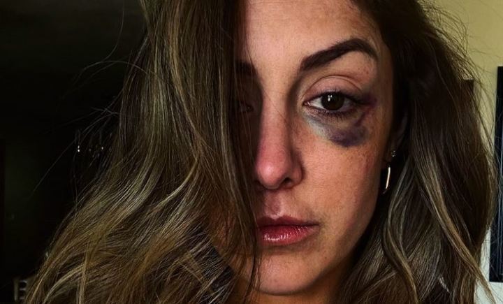 Britt Baker Comments On Controversy Surrounding Her AEW Black Eye T-Shirt Wrestling News – WWE News, AEW News, WWE Results, Spoilers, WWE Backlash 2023 Results
